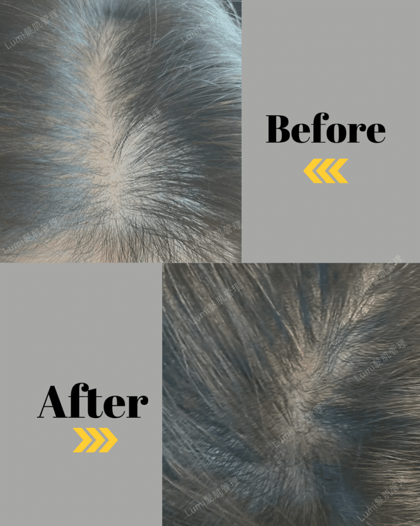 Lumi 案例示意圖-2